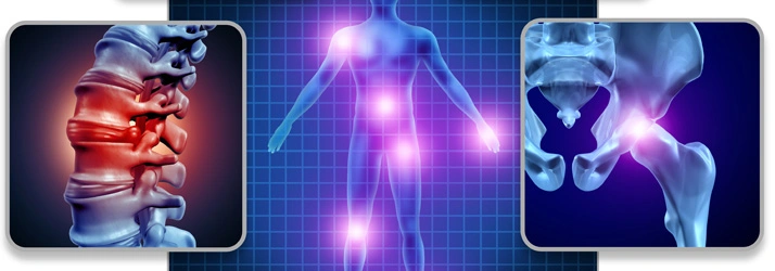 A 3-D scan of a body with close-up scans of the spine and hip, which are both highlighted in pain